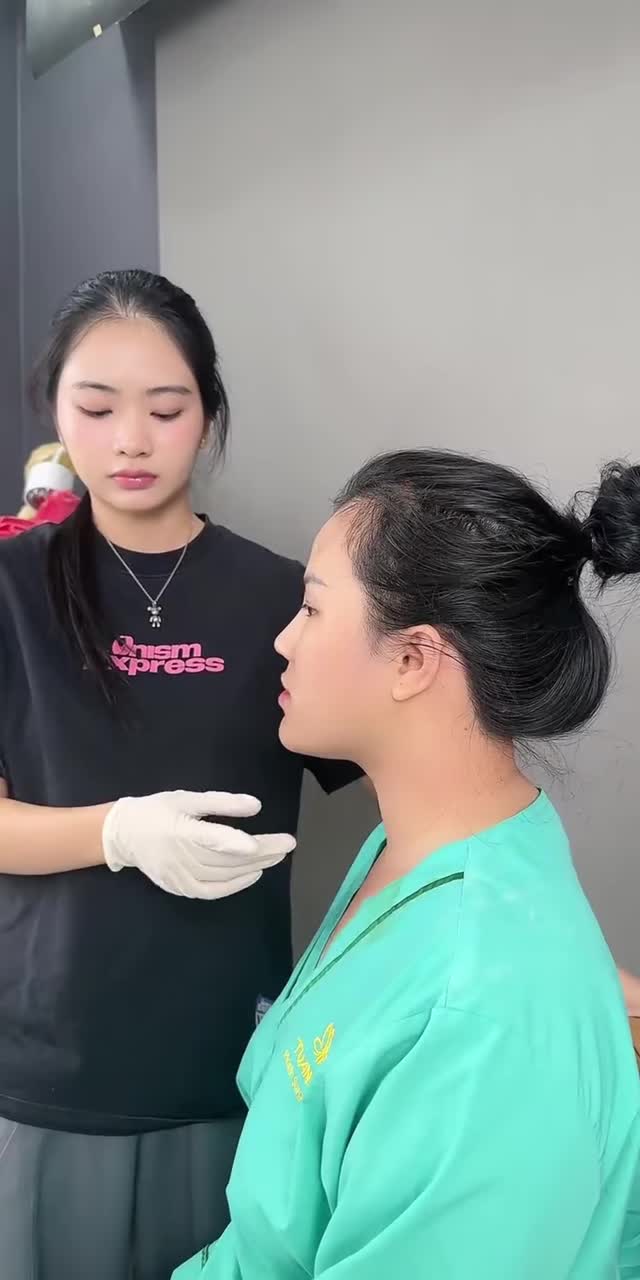 HOÀN THÀNH CA NÂNG MŨI BỌC SỤN RÚT CHỈ