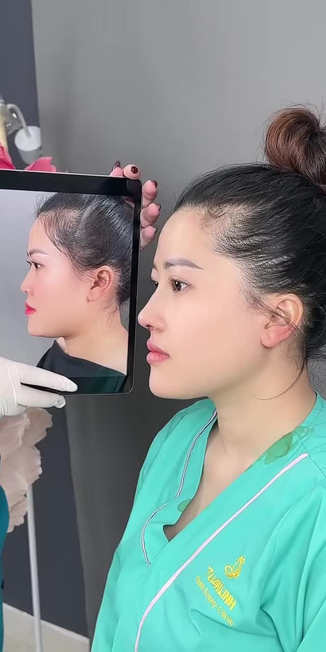 MŨI CẤU TRÚC MÀI GỒ - PHƯƠNG PHÁP TỐI ƯU CẢI THIỆN ĐỒNG THỜI NHIỀU KHUYẾT ĐIỂM