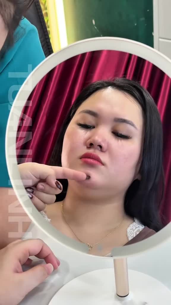 NÂNG MŨI + HÚT MỠ NỌNG CẰM: CÔNG THỨC VÀO TẠO GÓC NGHIÊNG HÒAN HẢO