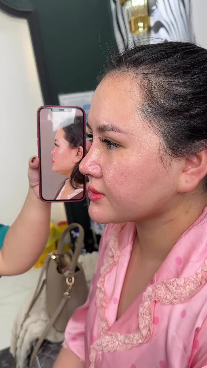 Combo mũi nọng cằm