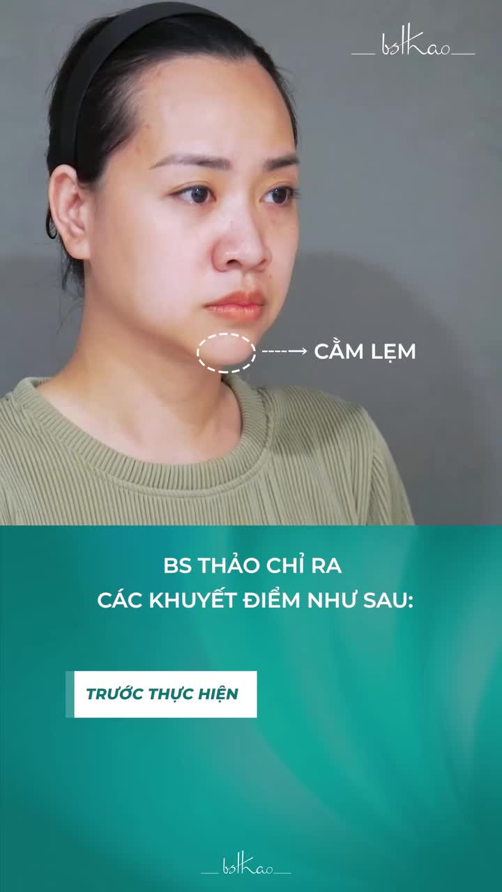 Lấy lại vẻ tươi trẻ cho khuôn mặt ở tuổi U40 như thế nào?