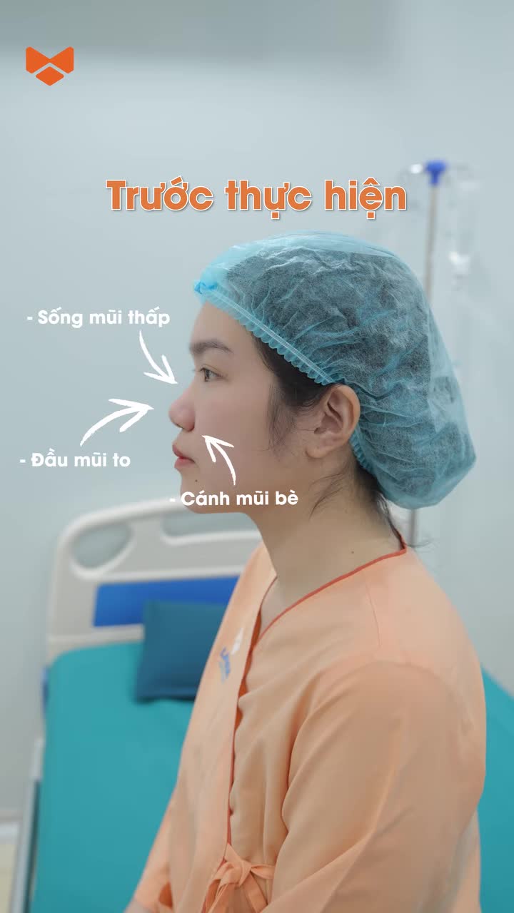 Một trong những quyết định thay đổi cuộc đời của khách hàng nhà Ratio đó chính là Nâng mũi