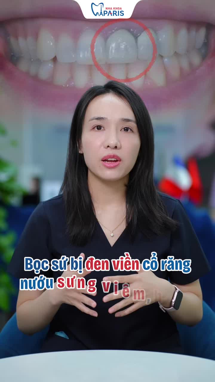 BỌC RĂNG SỨ CÓ BỊ ĐEN VIỀN NƯỚU VÀ HÔI MIỆNG KHÔNG?