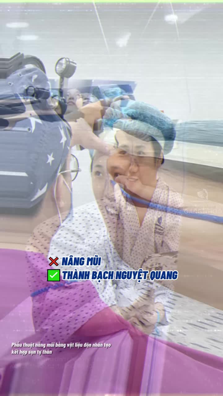 Một chiếc mũi mới một vibe “bạch nguyệt quang” mới