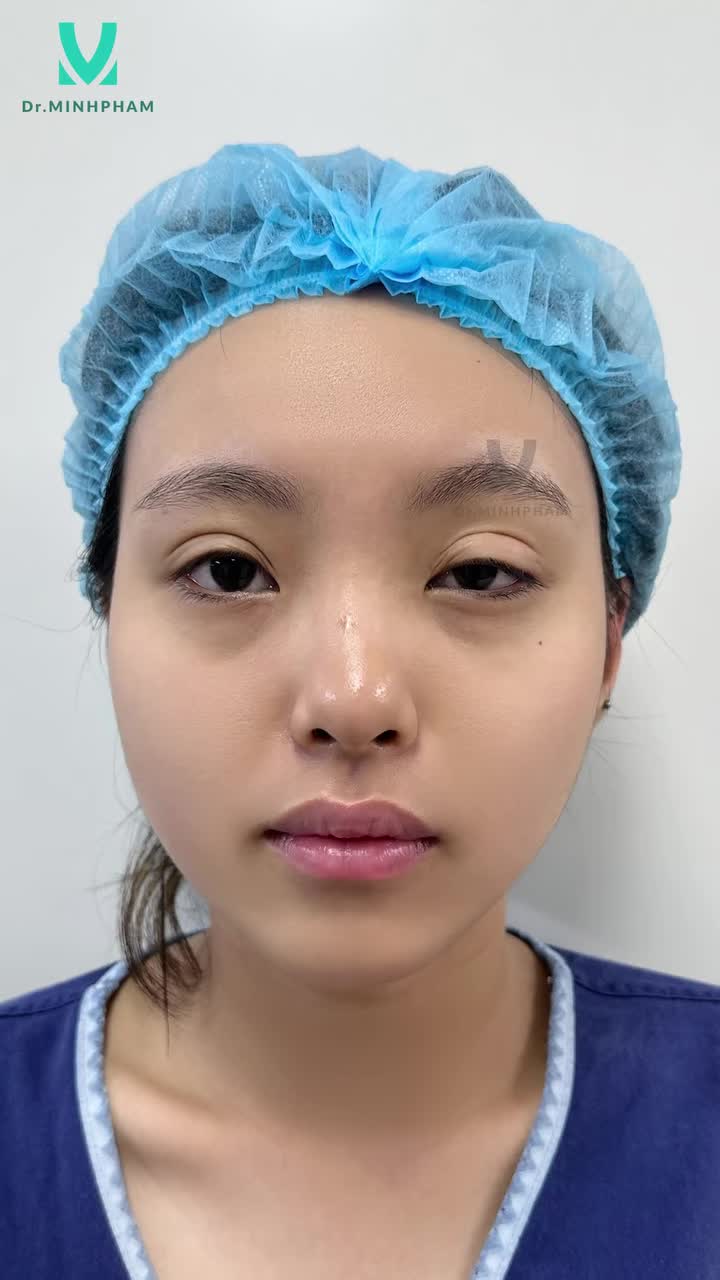ĐÔI MẮT CUỐN HÚT – THẦN THÁI RẠNG RỠ