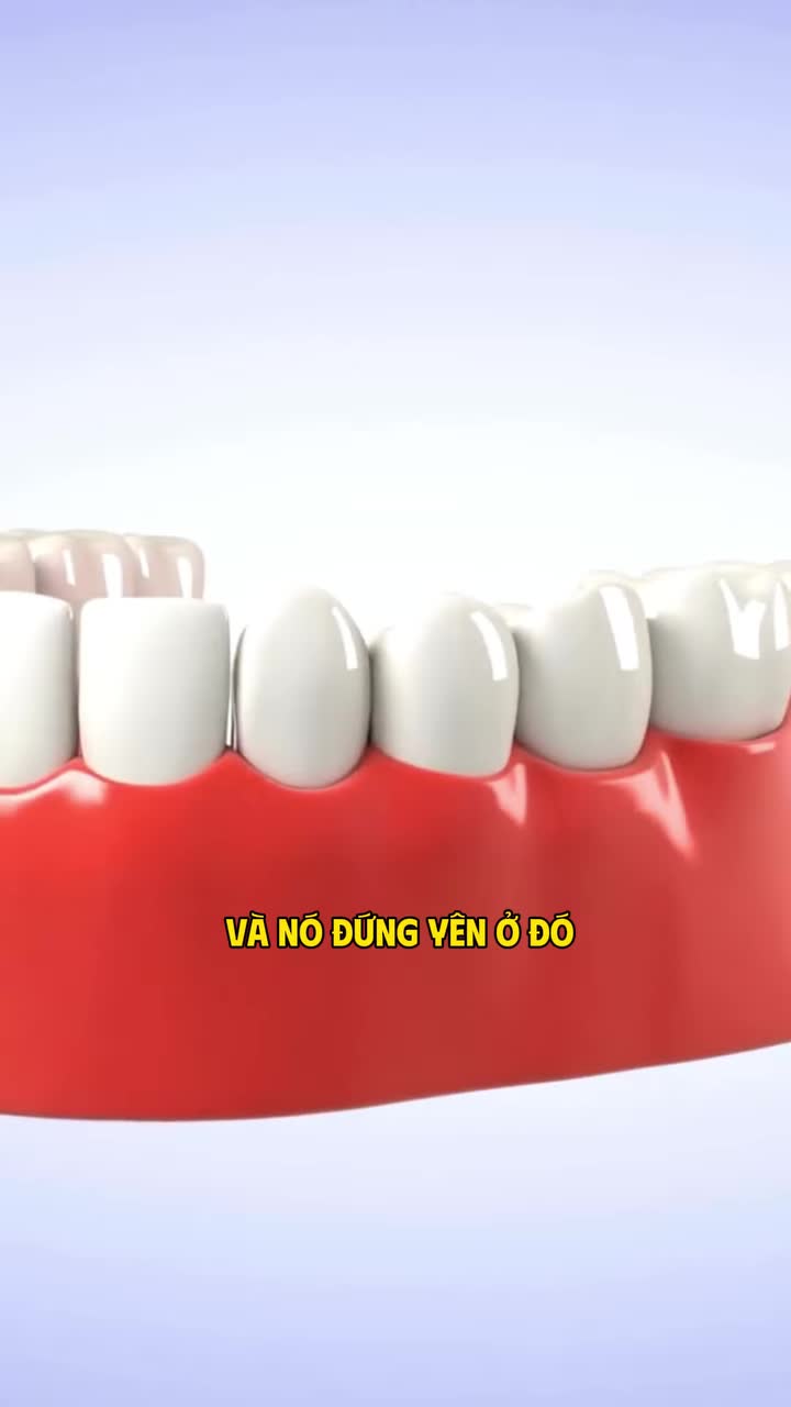 IMPLANT TÍCH HỢP VỚI XƯƠNG HÀM NHƯ THẾ NÀO?