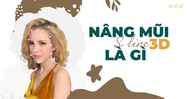 Nâng mũi S Line 3D là gì? Nâng mũi S Line 3D giá bao nhiêu?