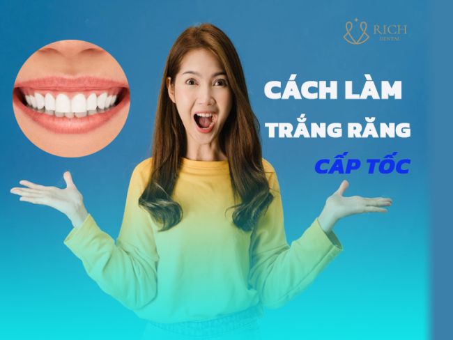 Cách Làm Trắng Răng Cấp Tốc Vẫn Đảm Bảo An Toàn Và Lành Tính