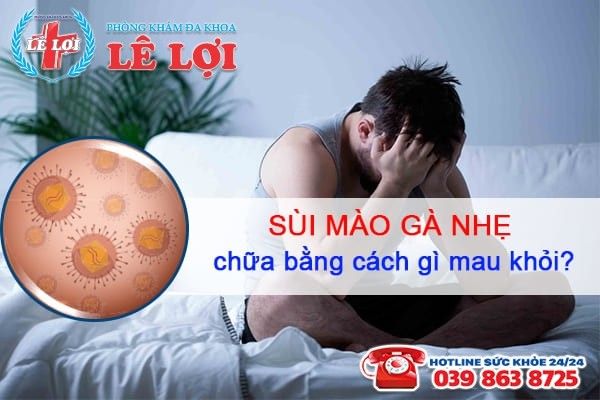Bệnh sùi mào gà nhẹ chữa cách nào mau khỏi?