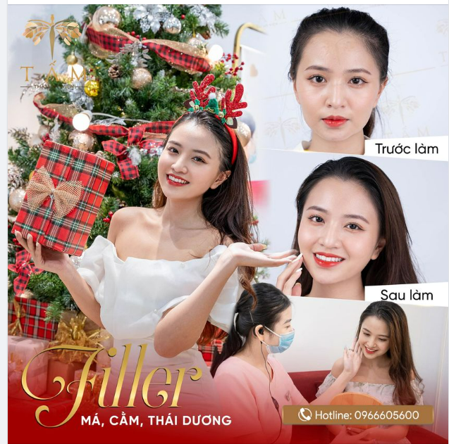 Giáng sinh lung linh cùng Combo Filler Má, Cằm, Thái dương