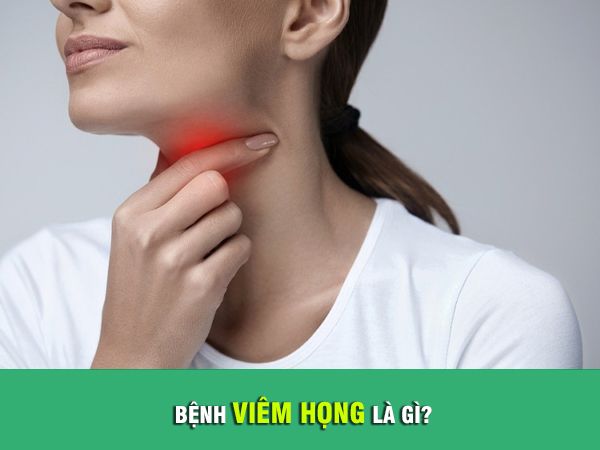 Bệnh viêm họng là gì? Nguyên nhân, triệu chứng và biến chứng của viêm họng