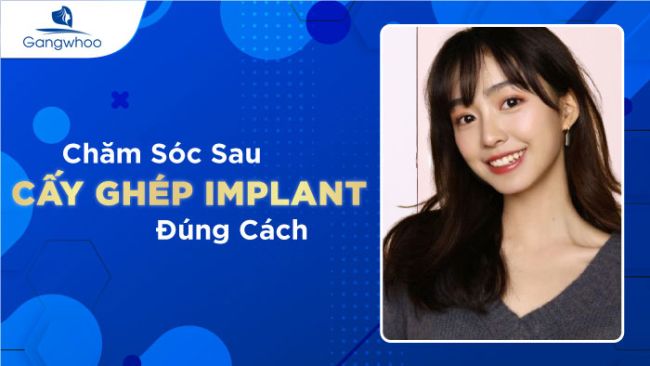 Chăm Sóc Sau Cấy Ghép Implant Đúng Cách Để Ngăn Ngừa Biến Chứng