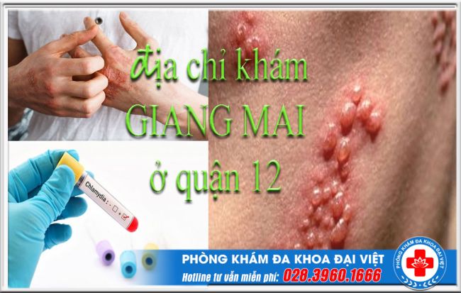 Địa chỉ khám giang mai ở quận 12 chuẩn bệnh viện lớn