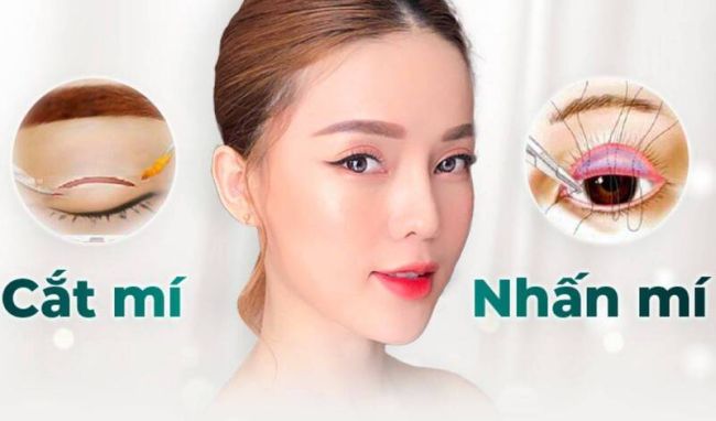Nên cắt mí hay nhấn mí sẽ tốt hơn? Ưu nhược điểm là gì?