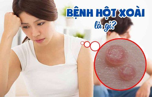 Bệnh hột xoài là gì? Có nguy hiểm không?