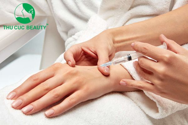 Tiêm filler bàn tay là gì? Đối tượng chỉ định thực hiện