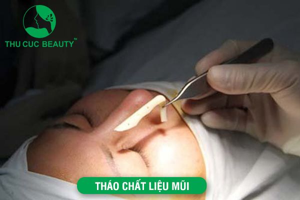 Rút chất liệu mũi - Bệnh viện Thẩm mỹ Thu Cúc