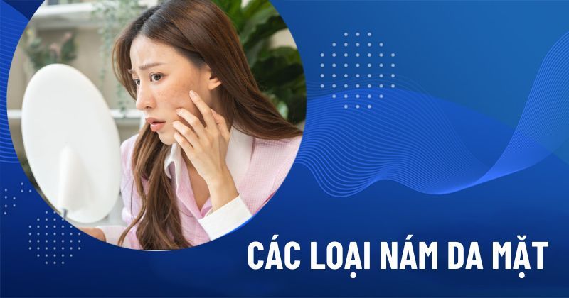 Các loại nám da mặt phổ biến: Cách phân biệt và hình ảnh chi tiết