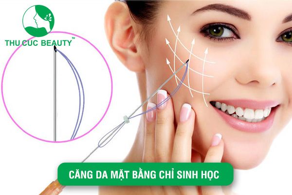 Căng da mặt bằng chỉ sinh học - Bệnh viện Thẩm mỹ Thu Cúc