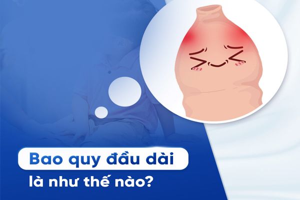 Dài bao quy đầu là gì? Cắt dài bao quy đầu bằng cách nào? - Phòng Khám Đa Khoa Tâm Đức Đắk Lắk