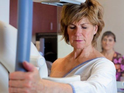 Ung thư vú tiểu thùy: Tiên lượng và tỉ lệ sống ra sao?