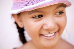 Tại sao bé lại có nốt ruồi?