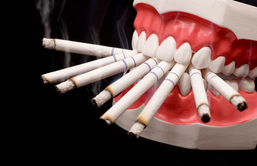 Hút thuốc lá và sức khỏe răng miệng