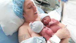 Sinh đẻ khi mang đa thai