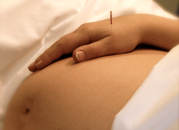 Châm cứu trong thai kỳ có an toàn không?