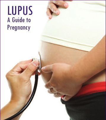 Kiểm soát bệnh lupus khi mang thai