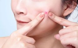 6 vấn đề về da khi mang thai