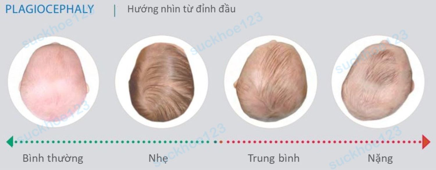 Kiểu tóc nào có thể che khuyết điểm của bạn  Thời trang  Việt Giải Trí