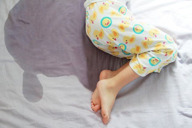 Các nguyên nhân khiến trẻ đái dầm