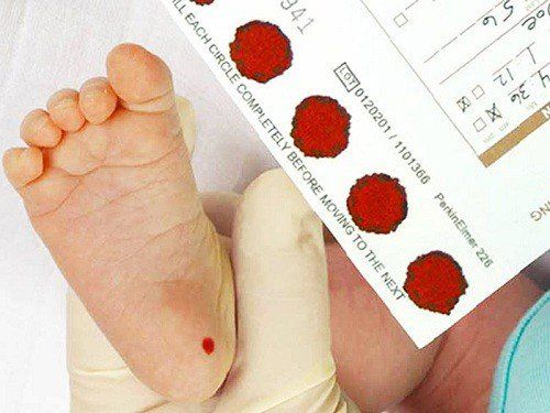 Thiếu men G6PD: Bệnh có thể phát hiện nhờ sàng lọc sơ sinh