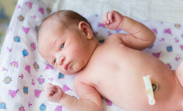 Nhận diện và xử trí nhiễm trùng rốn ở trẻ sơ sinh