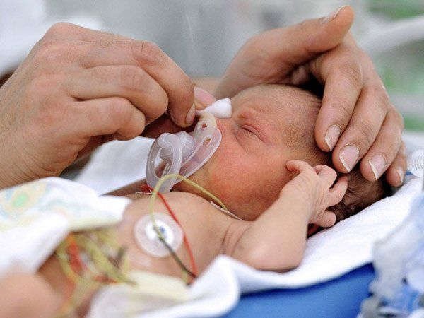 Vì sao cần tầm soát bệnh võng mạc cho trẻ sinh non?