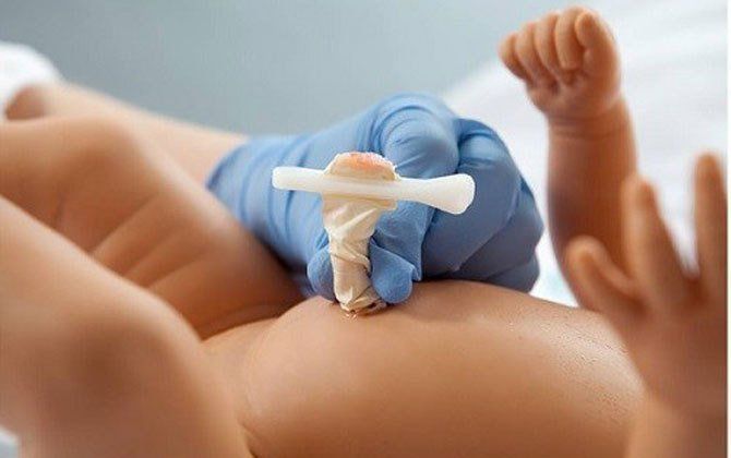 Sau sinh bao lâu trẻ sẽ rụng rốn?