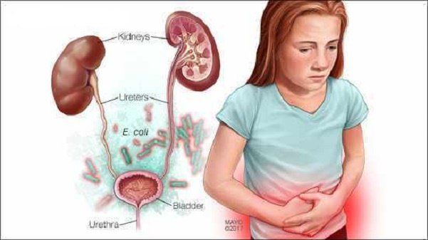 Nguyên nhân, dấu hiệu trẻ bị viêm đường tiết niệu