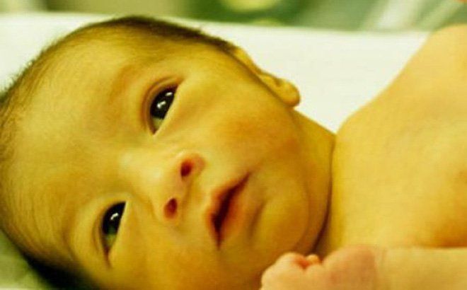 Thế nào là vàng da nhân não?