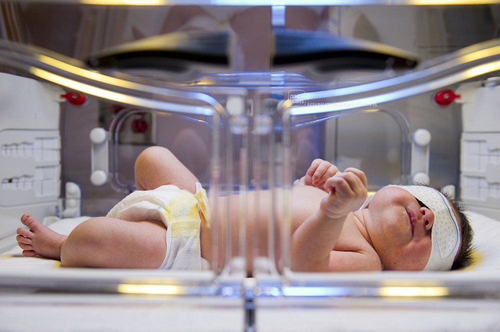 Thế nào là vàng da nhân não?
