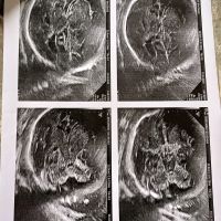 Kích thước bể lớn hố sau như này có đáng lo ngại không?