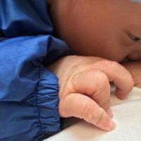 Bé gần 4 tháng bị nổi mụn nước ở tay và chân