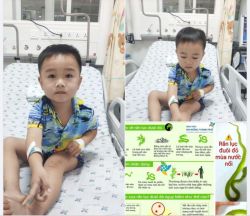 Thoát cơn hoảng sợ sau khi bị rắn cắn, cậu bé hồn nhiên hí hửng khoe chiến tích mãnh liệt của đời trai trẻ