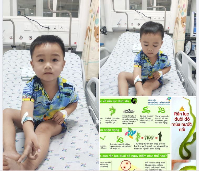 Thoát cơn hoảng sợ sau khi bị rắn cắn, cậu bé hồn nhiên hí hửng khoe chiến tích mãnh liệt của đời trai trẻ