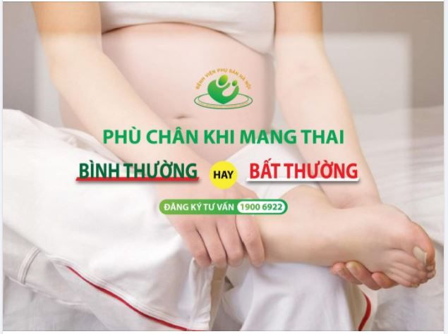 Phù chân khi mang thai: bình thường hay bất thường?