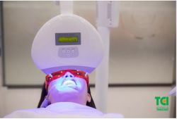6 LÍ DO NÊN LỰA CHỌN TẨY TRẮNG RĂNG LASER WHITENING