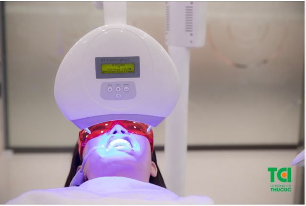6 LÍ DO NÊN LỰA CHỌN TẨY TRẮNG RĂNG LASER WHITENING