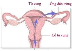 Viêm ống dẫn trứng - Bệnh viện  Từ Dũ
