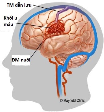 Chọn tư thế đúng khi cho con bú- bệnh viện nhi Trung Ương