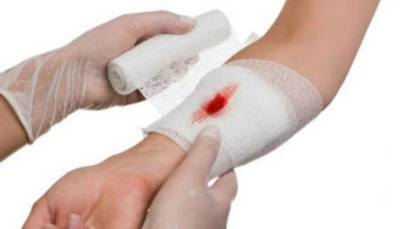 Sơ cứu nạn nhân có vết thương chảy máu - Bệnh viện nhi Trung Ương